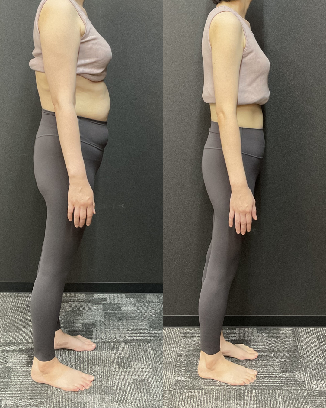 40代 Aさま -11.4kg