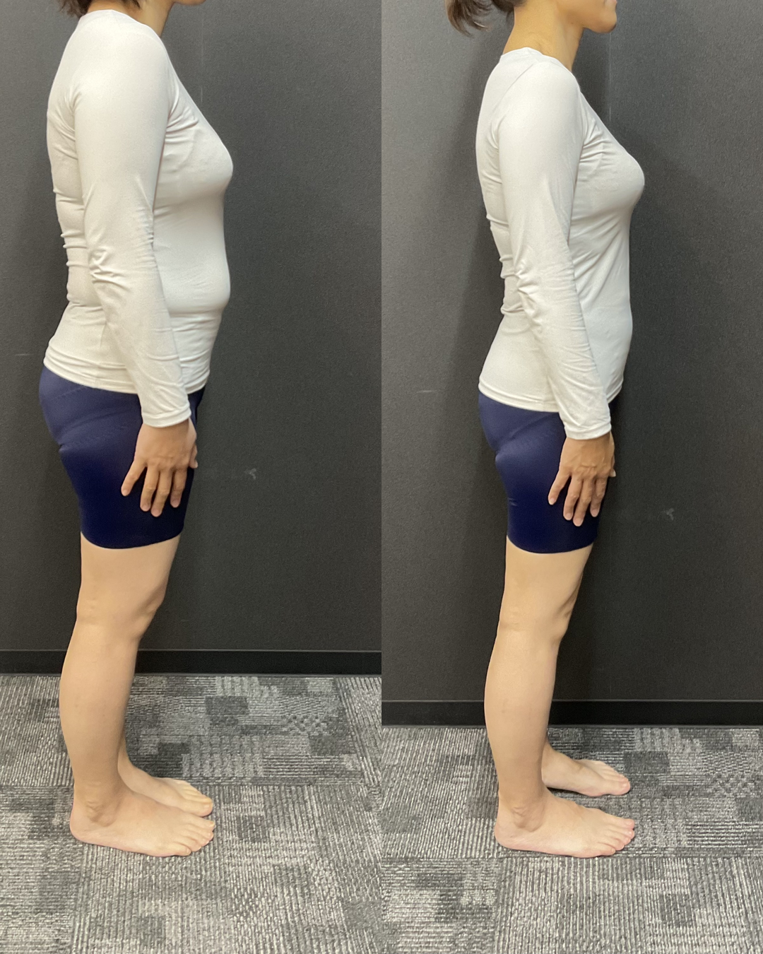 40代 Kさま -7.8kg