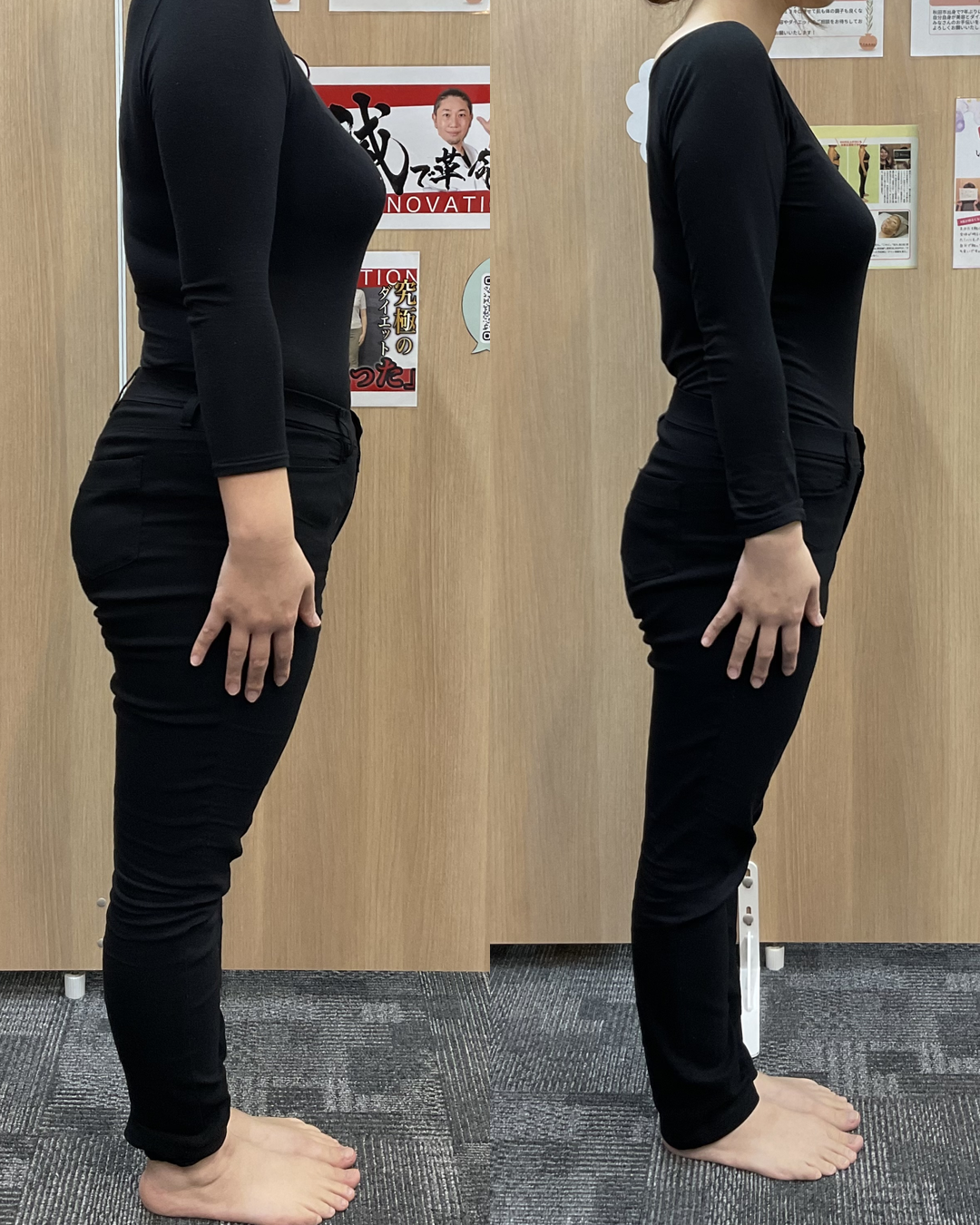 30代 Kさま -8.5kg