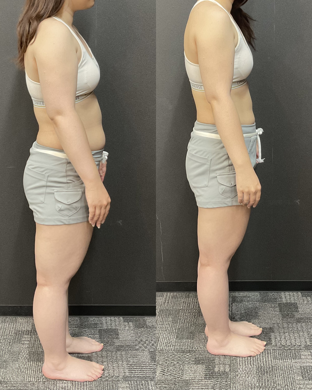 30代 Kさま -9.2kg