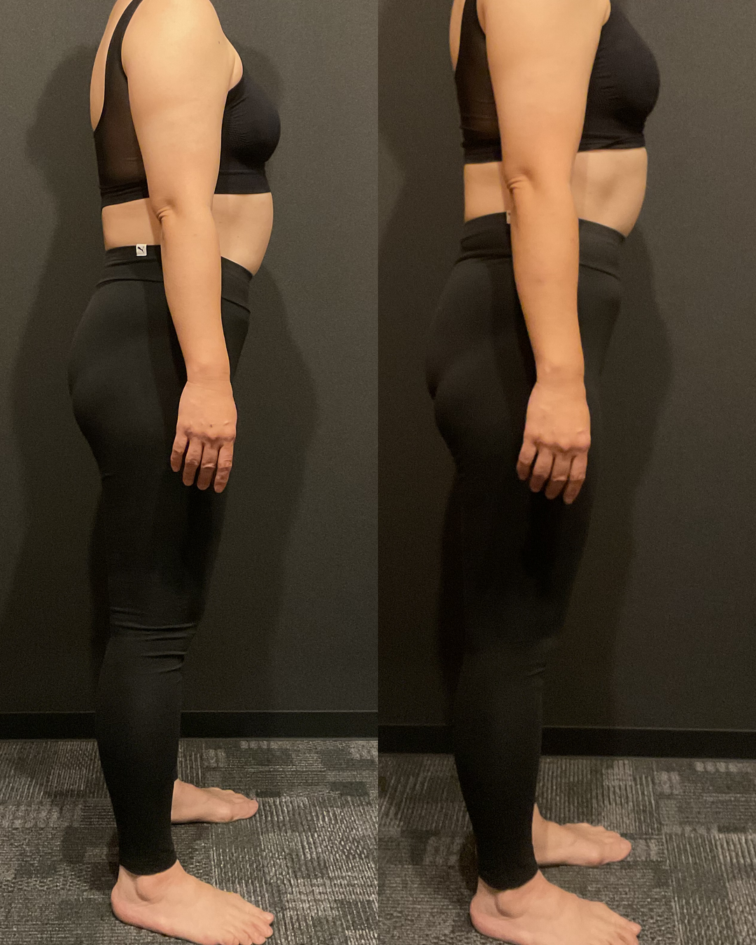 50代 Kさま -12.0kg