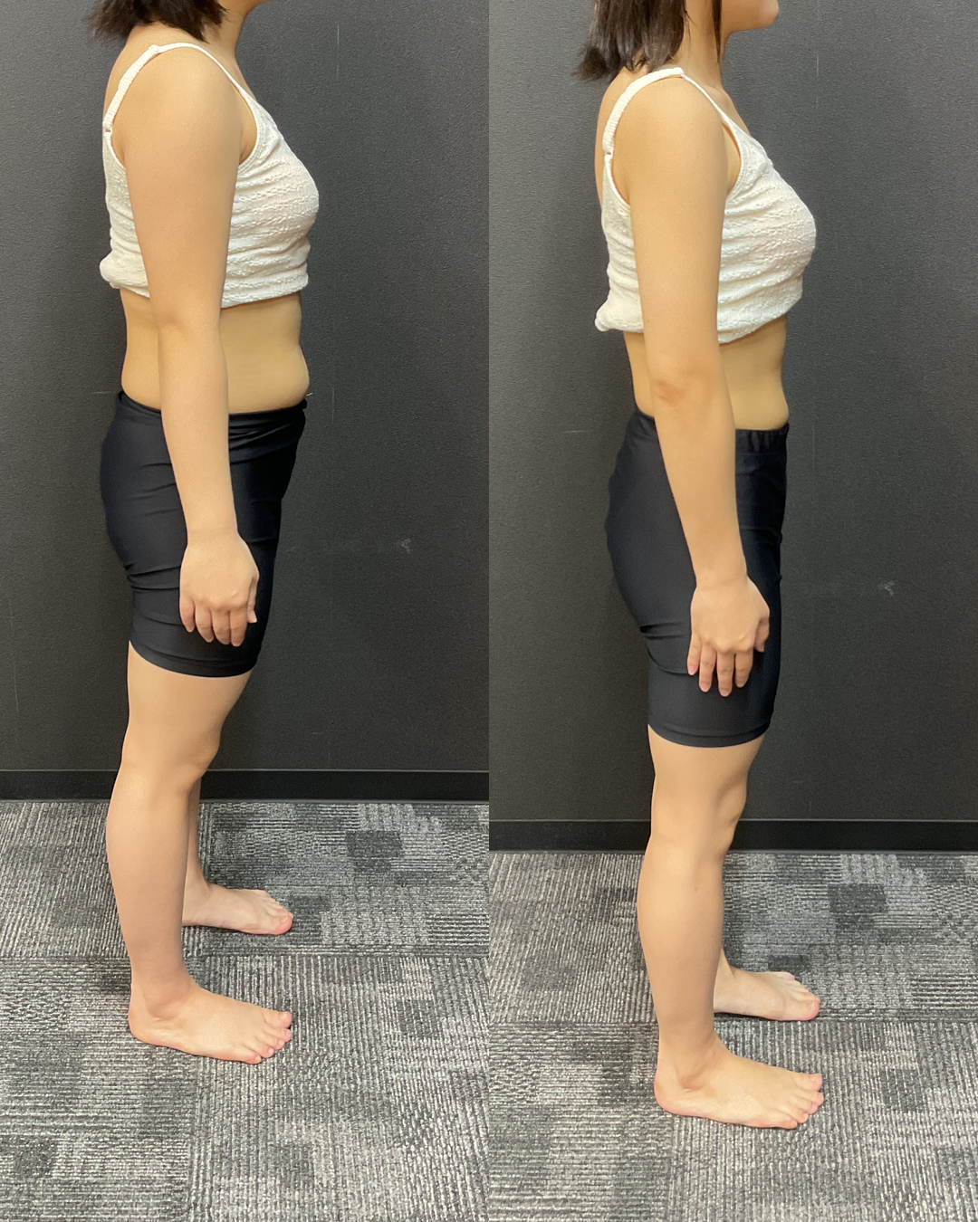 20代 Tさま -7.7kg