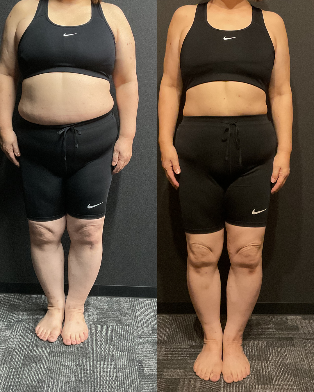 50代 Tさま -13.2kg