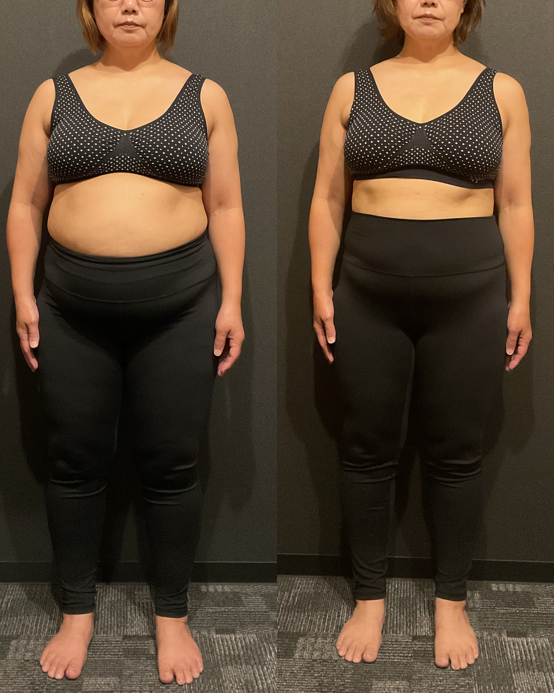 50代 Yさま -16.2kg