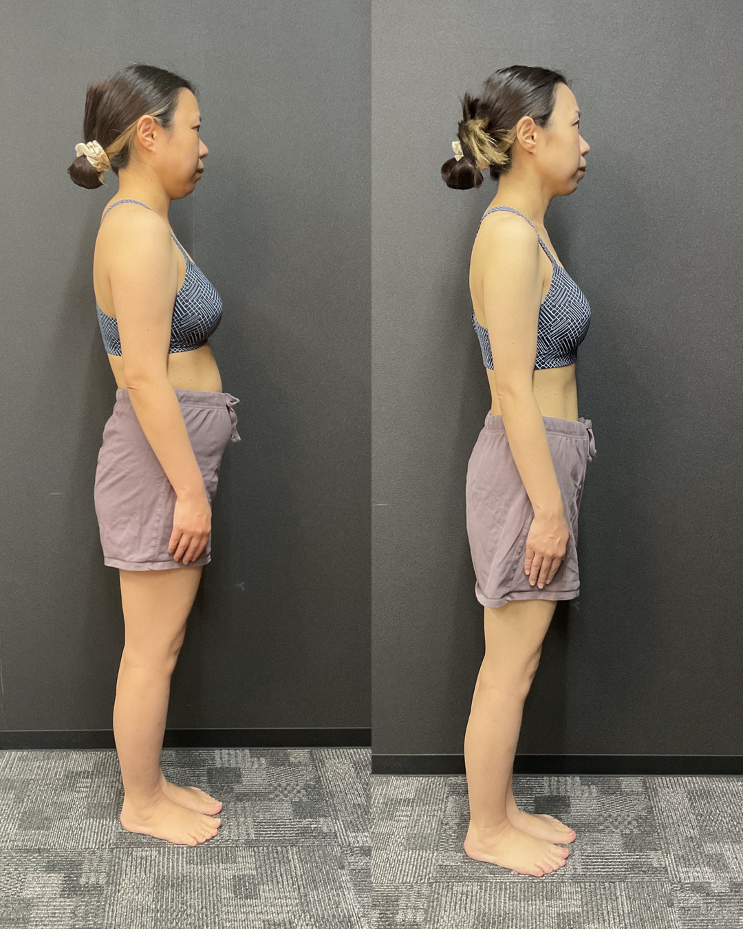 40代 Mさま -11.9kg