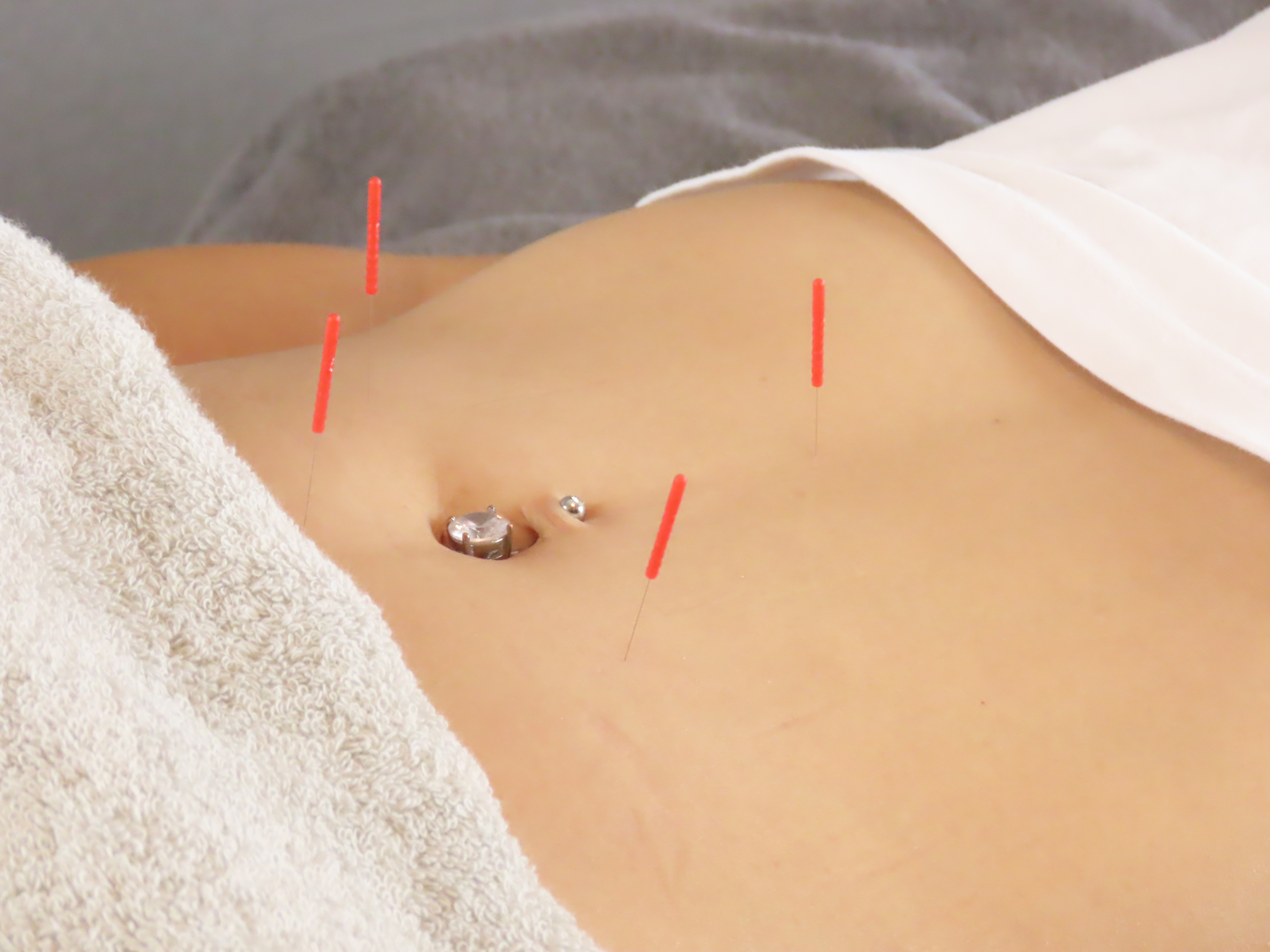 Hari-Slim beauty 痩身鍼灸 腹部施術